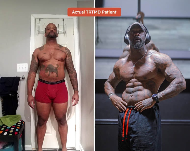 Benefits and Side Effects of Testosterone Replacement Therapy